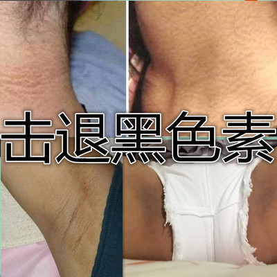 私处美白去黑色素乳头晕腋下脖子嘴唇变粉嫩红素私密处护理液正品-淘宝网