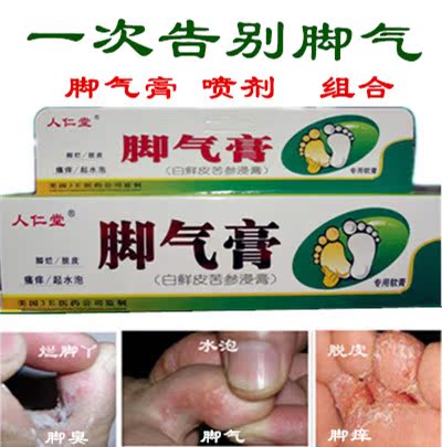 脚气膏 去除脚气水泡脱皮脚痒脚臭脚型脚气药膏喷剂