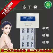 Miaofang đông khô bột mặt bản chất hydrating mụn marks 2018 nhân viên bán hàng đề nghị quầy xác thực quốc gia snapped