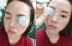 Làm dịu mắt quá mức mà không cần chất bảo quản Renhe Ingenious Tea Polyphenol Eye Care 300ml - Phụ kiện chăm sóc mắt
