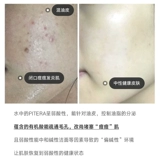 Эссенция для ухода за кожей, увлажняющее масло для жирной кожи, 230 мл, 230 мл