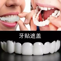 Зубные наклейки покрывают зазор зубного зазора, фальшивые скобки, стоматологическое моделирование и поддельный зуб, зубной сустав, заполняющий коррезок артефакта большие зубы