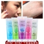 Facial Exfoliating Gel Kem Tẩy Tế Bào Chết Nữ Nam Mặt Tẩy Tế Bào Chết Sữa Rửa Mặt cho Mụn Cơ Thể Chà tẩy da chết mặt tại nhà