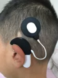 Shengsheng 2023 Новая патентная версия австрийского сонета Cochlea Anty -Despeat Cover, катушка, ушной замок