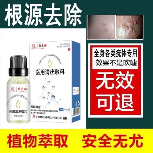 Удаление поверхности плоской бородавки артефактных шелковых бородавок для удаления бородавок, вирусных бородавок Специальные эффекты Специальные эффекты