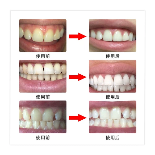 Jiajieshi отбеливающая зуб