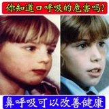 Дыхательные ортезы, детский слюнявчик для сна для правильного прикуса