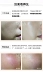 Sửa chữa và cải thiện các vấn đề về da! Hàn Quốc Dongguo Dược phẩm Centellian24 Centella Grass Mask 10 cái mặt nạ dưỡng trắng Mặt nạ