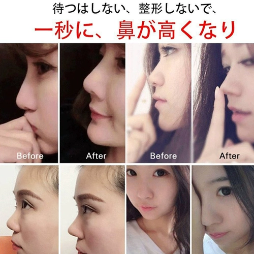 Устройство повышения носа в Японии уменьшает артефакт носа в носу, артефакт носа, ринопластика, тонкий нос, красотка, нос артефакт.