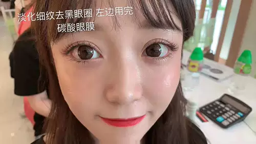 Японская элитная угольная кислота, осветляющая маска для глаз, magic: the gathering, против темных кругов под глазами, 8 пары