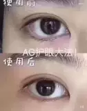 Япония Milagro Ag Eye Таблетки 90 активированные DHA Lutelin Muscle Care Eyes Dry Dry