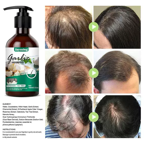 Шампунь для роста волос с чесноком против жидкости