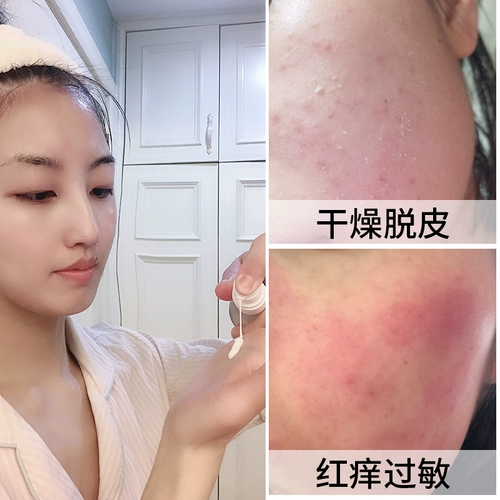 Керамид, восстанавливающий лосьон, успокаивающий увлажняющий крем, восстанавливающие румяна