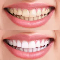 Dai Shi Han Yisheng Yanssheng Powder Powder Destry Pourge Удаляет Huang Liangbai, снятый зубной дезодорирующий рот и зубной зубной порошок зубов зубов.