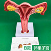 B models bilateral ovarian uterus +delivery drawing