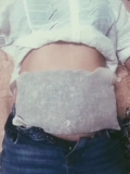 В июне я рекомендую трансплантацию с горячим сжатием теплого дворца перед подготовкой к беременности.