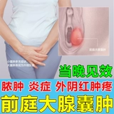 Зарубежные железы Barlin Cysts Sparse Drugs для лечения опухолей женщин вульвы и опухшего больного гинекологического геля