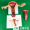 C type normal uterus +drawing paper