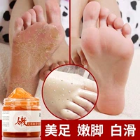 Mua 2 tặng 1 chân keratin kem tẩy tế bào chết da chết cũ dịu dàng dịu dàng feet làm trắng mặt nạ chân mặt nạ chân kem ủ gót chân