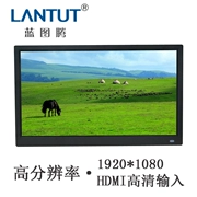 Xanh totem 15,6-inch độ nét cao khung ảnh kỹ thuật số album điện tử mỏng tiêu chuẩn HDMI giao diện 1080P - Khung ảnh kỹ thuật số