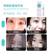Huimeifang chăm sóc da thủ công Tinh chất tơ tằm Fengxiao túi hốc mắt trầm cảm làm đầy nước mắt mương tinh dầu miễn phí rửa 12 ml - Tinh dầu điều trị