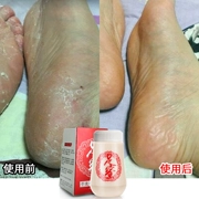 Mua 2 tặng 1 khô bột thơm bột bột bột lâu dài chất chống mồ hôi khô để cải thiện mùi chăm sóc bàn chân nam giới và phụ nữ